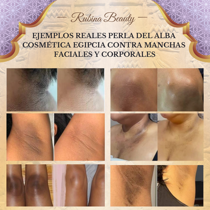 PACK DESPIGMENTANTE PERLA DEL ALBA STEP 1 + STEP 2 RUBINA BEAUTY