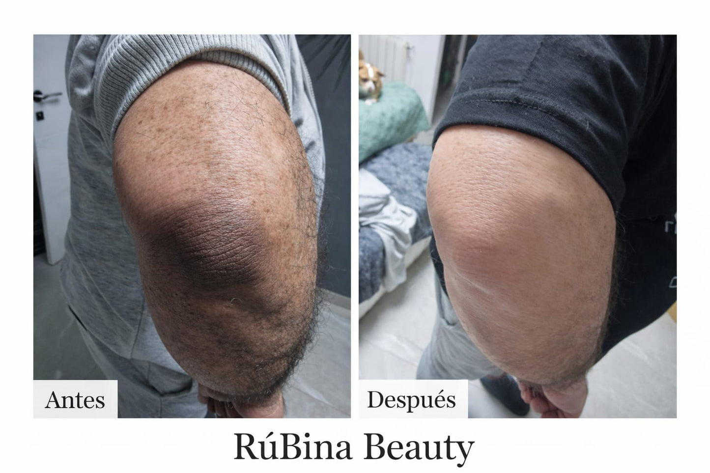 PACK DESPIGMENTANTE PERLA DEL ALBA STEP 1 + STEP 2 RUBINA BEAUTY